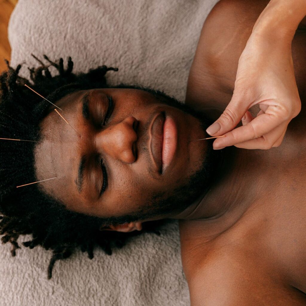 Man lies calmly on an acupuncture table while needles are inserted into his face.