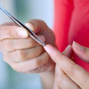 Person who seems to experience a hair splinter uses tweezers to remove the hair splinters from their finger.