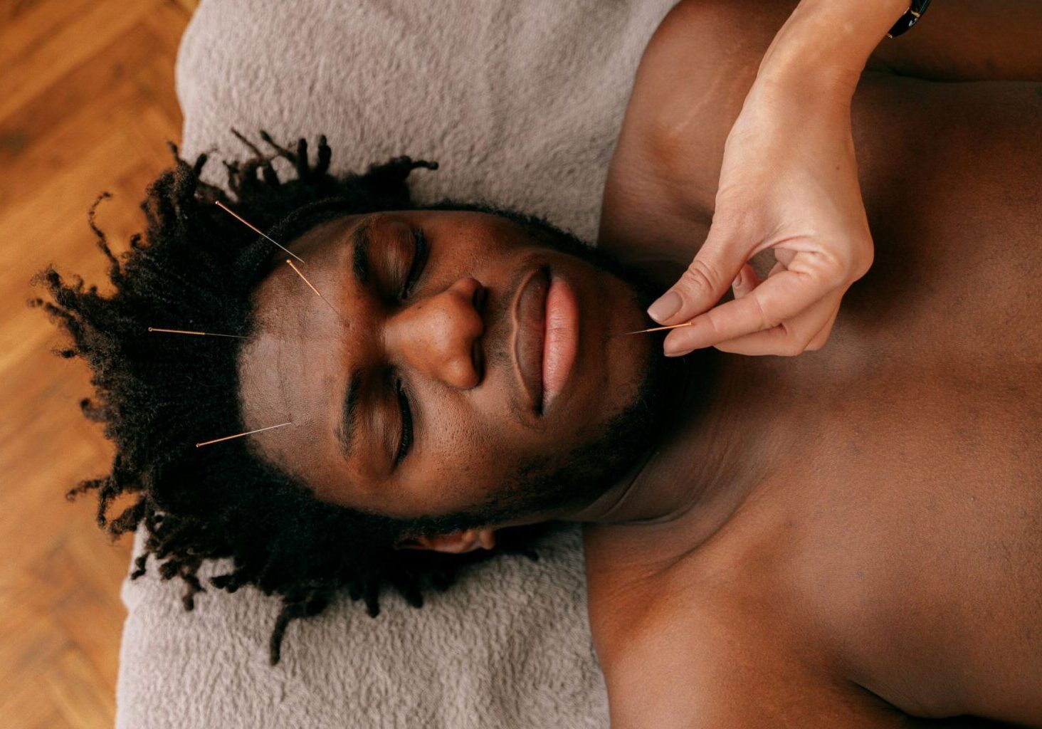 acupuncture-gone-wrong Man lies calmly on an acupuncture table while needles are inserted into his face.